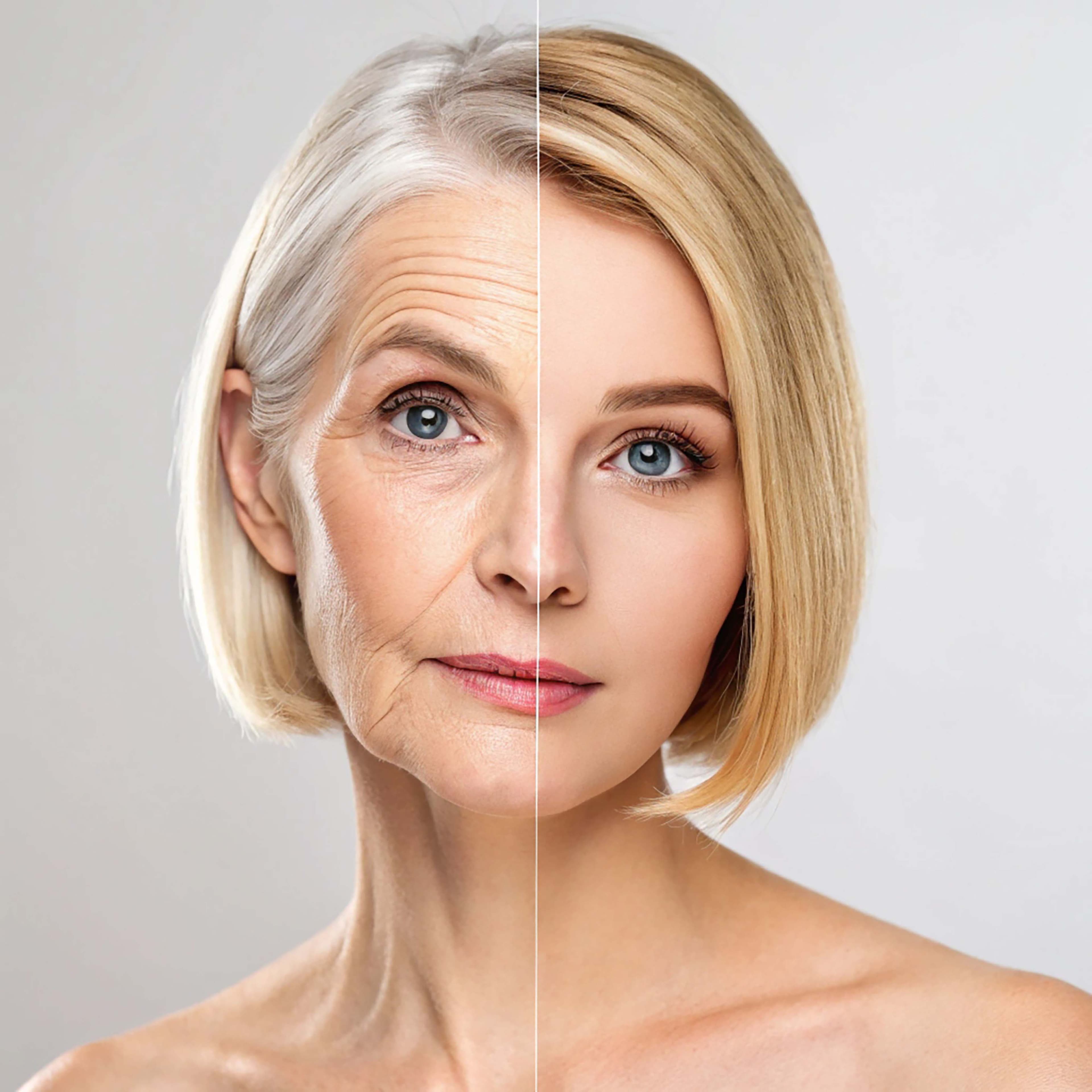 anti-aging